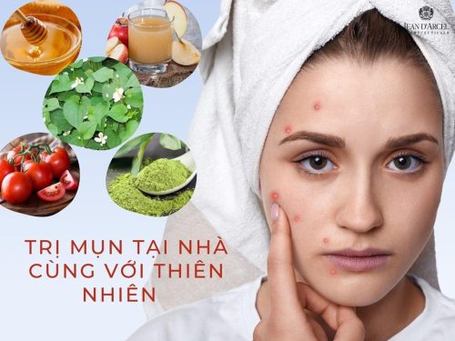 CÁCH TRỊ MỤN TẠI NHÀ BẰNG NGUYÊN LIỆU TỰ NHIÊN SẴN CÓ