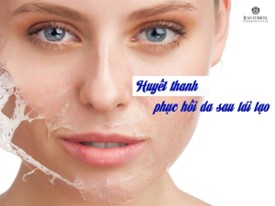 HUYẾT THANH PHỤC HỒI DA SAU TÁI TẠO