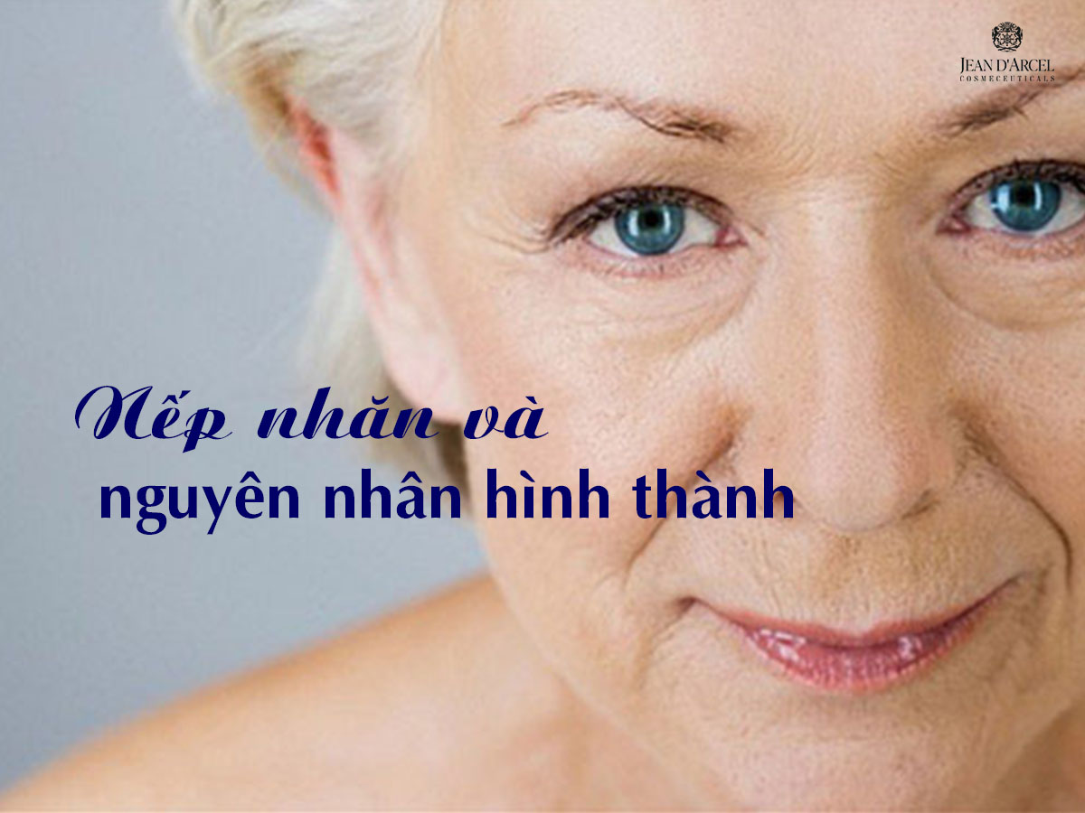 Nếp Nhăn Và Nguyên Nhân Hình Thành