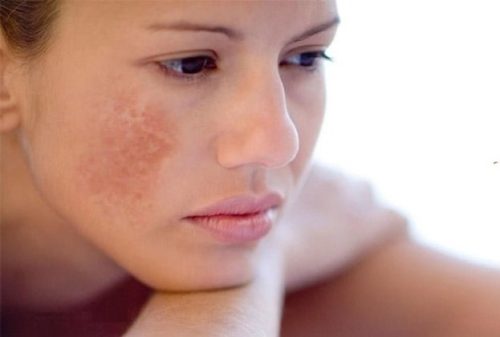 Những Ảnh Hưởng Khi Thiếu Hụt Nội Tiết Tố Nữ Và Cách Bổ Sung