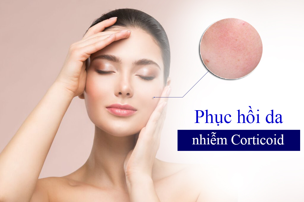 Cách Nhận Biết Và Phục Hồi Làn Da Nhiễm Corticoid