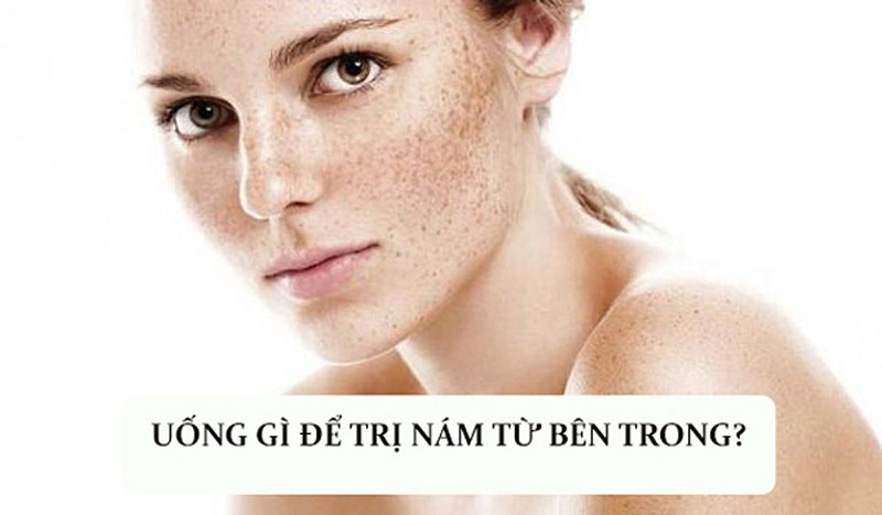 Uống Gì Để Trị Nám Da Từ Bên Trong Bằng Các Nguyên Liệu Có Sẵn Tại Nhà?