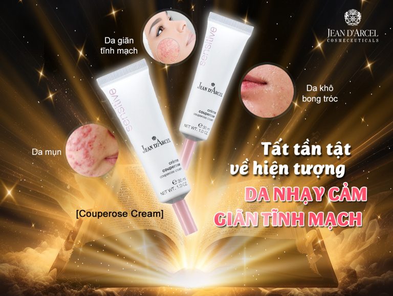 TẤT TẦN TẬT VỀ HIỆN TƯỢNG DA NHẠY CẢM GIÃN TĨNH MẠCH