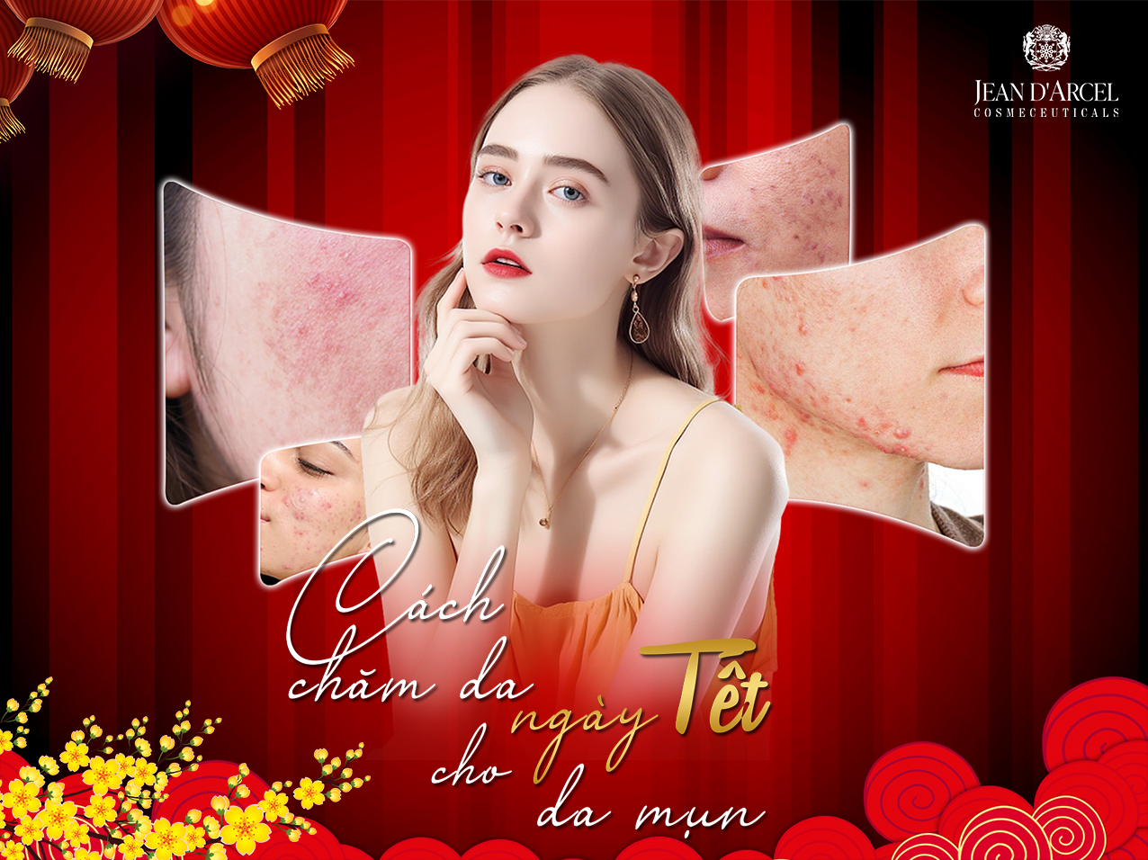 CÁCH CHĂM DA NGÀY TẾT CHO DA MỤN - Jean d'Arcel Việt Nam