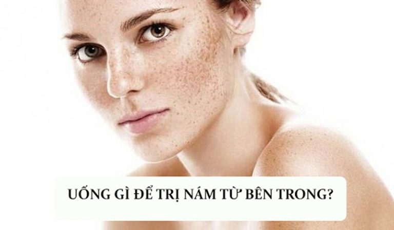 Uống Gì Để Trị Nám Da Từ Bên Trong Bằng Các Nguyên Liệu Có Sẵn Tại Nhà?