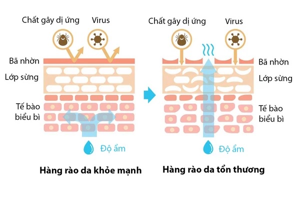 Phục Hồi Hàng Rào Bảo Vệ Da Bao Lâu?
