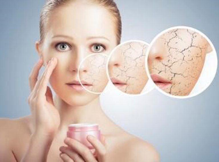 Da Dầu Mụn Dễ Mất Cân Bằng pH: Nguyên Nhân Và Cách Khắc Phục